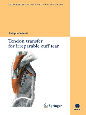 cover image of Tendon transfer for irreparable cuff tear